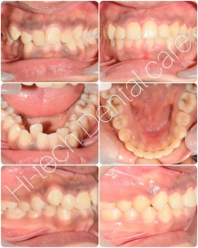 Dental treatment before and after result